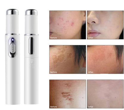 Scar Removal Phototherapy Pen Cream – Asia’s Best-Selling Expert-Recommended Formula for Fading Old Scars & Stretch Marks Naturally