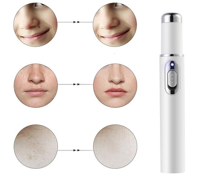 Scar Removal Phototherapy Pen Cream – Asia’s Best-Selling Expert-Recommended Formula for Fading Old Scars & Stretch Marks Naturally