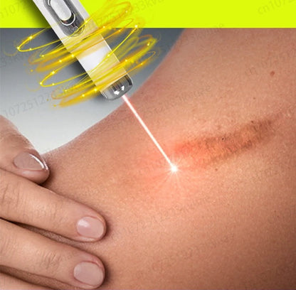 Scar Removal Phototherapy Pen Cream – Asia’s Best-Selling Expert-Recommended Formula for Fading Old Scars & Stretch Marks Naturally